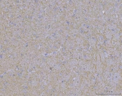 IHC staining of FFPE mouse brain tissue with WDR7 antibody. HIER: boil tissue sections in pH8 EDTA for 20 min and allow to cool before testing.