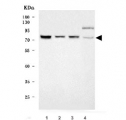 Western blot testing of human 1) K562, 2) MOLT4, 3) U-251 and 4) HeLa cell lysate with TRMT44 antibody. Predicted molecular weight ~85 kDa.