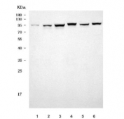 Western blot testing of 1) human HaCaT, 2) human HepG2, 3) human U-87 MG, 4) rat testis, 5) rat C6 and 6) mouse RAW264.7 cell lysate with TMC7 antibody. Predicted molecular weight ~84 kDa but may be observed at higher molecular weights due to glycosylation.