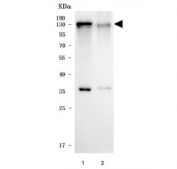 Western blot testing of human 1) K562 and 2) U-2 OS cell lysate with SAGE1 antibody. Predicted molecular weight ~99 kDa.