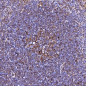 IHC staining of FFPE mouse spleen tissue with Light antibody. HIER: boil tissue sections in pH8 EDTA for 20 min and allow to cool before testing.