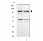 Western blot testing of human 1) SH-SY5Y and 2) HepG2 cell lysate with Activated CDC42 kinase 1 antibody. Predicted molecular weight ~114 kDa.