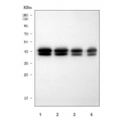 Western blot testing of 1) human milk (5ul), 2) human milk (5ul), 3) human milk (25ul) and 4) human milk (25ul) with Lactadherin antibody. Expected molecular weight: 30-66 kDa depending glycosylation level.