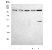 Western blot testing of 1) human SH-SY5Y, 2) human U-87 MG, 3) human U-251, 4) human SK-N-SH and 5) rat C6 cell lysate with TRPC7 antibody. Expected molecular weight ~100 kDa.