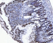 IHC staining of FFPE mouse rat tissue with C-terminal-binding protein 2 antibody. HIER: boil tissue sections in pH8 EDTA for 20 min and allow to cool before testing.
