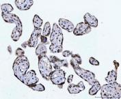 IHC staining of FFPE human placental tissue with C-terminal-binding protein 2 antibody. HIER: boil tissue sections in pH8 EDTA for 20 min and allow to cool before testing.