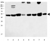 Western blot testing of 1) human HeLa, 2) human SiHa, 3) human COLO-320, 4) human SW620, 5) rat stomach, 6) rat brain, 7) mouse stomach and 8) mouse brain tissue lysate with C-terminal-binding protein 2 antibody. Predicted molecular weight ~49 kDa.