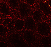 Immunofluorescent staining of FFPE mouse colon tissue with C-terminal-binding protein 2 antibody (red). HIER: steam section in pH8 EDTA buffer for 20 min.