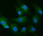 Immunofluorescent staining of FFPE human A549 cells with Toll-interacting protein antibody (green) and DAPI nuclear stain (blue). HIER: steam section in pH6 citrate buffer for 20 min.