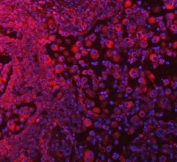 Immunofluorescent staining of FFPE human lung tissue with SELT antibody (red) and DAPI nuclear stain (blue). HIER: steam section in pH8 EDTA buffer for 20 min.
