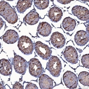 IHC staining of FFPE rat testis tissue with TOMM34 antibody. HIER: boil tissue sections in pH8 EDTA for 20 min and allow to cool before testing.