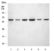 Western blot testing of 1) rat heart, 2) rat H9c2(2-1), 3) rat C6, 4) mouse heart, 5) mouse C2C12 and 6) mouse NIH 3T3 cell lysate with SETD3 antibody. Predicted molecular weight ~67 kDa.