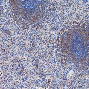 IHC staining of FFPE human spleen tissue with SETD3 antibody. HIER: boil tissue sections in pH8 EDTA for 20 min and allow to cool before testing.