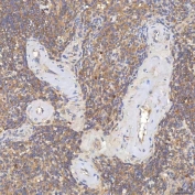 IHC staining of FFPE human spleen tissue with SGCE antibody. HIER: boil tissue sections in pH8 EDTA for 20 min and allow to cool before testing.