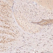IHC staining of FFPE mouse brain tissue with SGCE antibody. HIER: boil tissue sections in pH8 EDTA for 20 min and allow to cool before testing.
