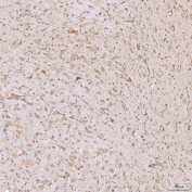 IHC staining of FFPE rat brain tissue with SGCE antibody. HIER: boil tissue sections in pH8 EDTA for 20 min and allow to cool before testing.