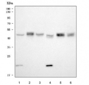 Western blot testing of 1) human U-251, 2) rat brain, 3) rat heart, 4) rat C6, 5) mouse brain and 6) mouse heart tissue lysate with SGCE antibody. Predicted molecular weight ~50 kDa.