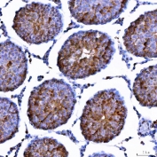 IHC staining of FFPE rat testis tissue with TRIM71 antibody. HIER: boil tissue sections in pH8 EDTA for 20 min and allow to cool before testing.