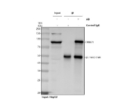 Immunoprecipitation of TRIM71 protein from 500ug of human HepG2 whole cell lysate with 2ug of TRIM71 antibody.