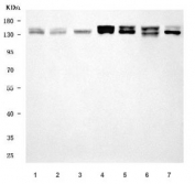 Western blot testing of 1) human HeLa, 2) human MCF7, 3) human K562, 4) human HepG2, 5) human U-87 MG, 6) rat PC-12 and 7) mouse NIH 3T3 cell lysate with SEC31A antibody. Predicted molecular weight : 107-133 kDa (multiple isoforms) with a possible ~57 kDa isoform.
