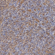IHC staining of FFPE human spleen tissue with SEC31A antibody. HIER: boil tissue sections in pH8 EDTA for 20 min and allow to cool before testing.