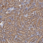 IHC staining of FFPE mouse kidney tissue with SEC31A antibody. HIER: boil tissue sections in pH8 EDTA for 20 min and allow to cool before testing.