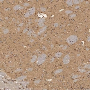 IHC staining of FFPE rat brain tissue with SEC31A antibody. HIER: boil tissue sections in pH8 EDTA for 20 min and allow to cool before testing.