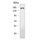 Western blot testing of human MCF7 cell lysate with TRPS1 antibody. Predicted molecular weight ~142 kDa, commonly observed at ~160 kDa.
