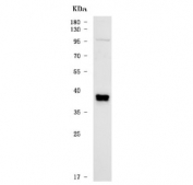Western blot testing of human LNCaP cell lysate with TSPY1/2/3/4 antibody. Predicted molecular weight: 33-36 kDa.