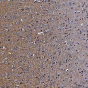 IHC staining of FFPE rat brain tissue with TTC7B antibody. HIER: boil tissue sections in pH8 EDTA for 20 min and allow to cool before testing.