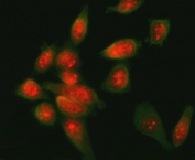 Immunofluorescent staining of FFPE human SiHa cells with ATF6 antibody (red) and Beta Tubulin mAb (green). HIER: steam section in pH6 citrate buffer for 20 min.