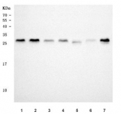 Western blot testing of 1) human HeLa, 2) human 293T, 3) human A549, 4) human MCF7, 5) rat brain, 6) mouse kidney and 7) mouse brain tissue with TSR2 antibody. Predicted molecular weight ~23 kDa, commonly observed at 23-30 kDa.