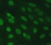 Immunofluorescent staining of FFPE human U-2 OS cells with SERINC2 antibody. HIER: steam section in pH6 citrate buffer for 20 min.