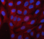 Immunofluorescent staining of FFPE human PC-3 cells with Alpha Taxilin antibody (red) and DAPI nuclear stain (blue). HIER: steam section in pH6 citrate buffer for 20 min.