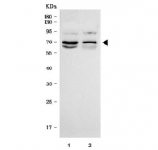Western blot testing of human 1) 293T and 2) K562 cell lysate with Acyl-CoA dehydrogenase family member 9 antibody. Predicted molecular weight ~69 kDa.