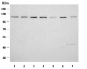 Western blot testing of 1) human Jurkat, 2) human HeLa, 3) human 293T, 4) human K562, 5) rat brain, 6) rat RH35, 7) mouse NIH 3T3 cell lysate with SF3b145 antibody. Predicted molecular weight ~100 kDa but commonly observed at up to ~145 kDa.