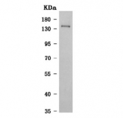 Western blot testing of human placenta tissue lysate with Nitric Oxide Synthase 3 antibody. Predicted molecular weight ~133 kDa.