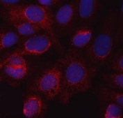 Immunofluorescent staining of FFPE human U-2 OS cells with Nitric Oxide Synthase 3 antibody (red) and DAPI nuclear stain (blue). HIER: steam section in pH6 citrate buffer for 20 min.