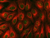 Immunofluorescent staining of FFPE human U-2 OS cells with SDCBP2 antibody (green) and Beta Tubulin mAb (red). HIER: steam section in pH6 citrate buffer for 20 min.