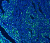 Immunofluorescent staining of FFPE human colorectal cancer with SEC23IP antibody (green) and DAPI nuclear stain (blue). HIER: steam section in pH8 EDTA buffer for 20 min.