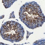 IHC staining of FFPE mouse testis tissue with SEC23IP antibody. HIER: boil tissue sections in pH8 EDTA for 20 min and allow to cool before testing.