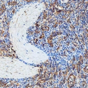 IHC staining of FFPE human spleen tissue with SEC23IP antibody. HIER: boil tissue sections in pH8 EDTA for 20 min and allow to cool before testing.