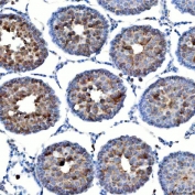IHC staining of FFPE rat testis tissue with TTLL2 antibody. HIER: boil tissue sections in pH8 EDTA for 20 min and allow to cool before testing.