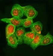 Immunofluorescent staining of FFPE human T-47D cells with RNase H2 subunit B antibody (red) and Alpha Tubulin mAb (green). HIER: steam section in pH6 citrate buffer for 20 min.