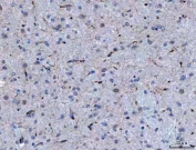 IHC staining of FFPE mouse brain tissue with Semaphorin-4F antibody. HIER: boil tissue sections in pH8 EDTA for 20 min and allow to cool before testing.