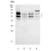 Western blot testing of human 1) Daudi, 2) Jurkat, 3) Raji and 4) K562 cell lysate with IKZF1 antibody. Expected molecular weight: ~65/55 kDa (isoforms 1/2).