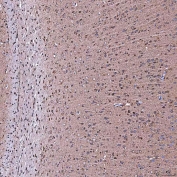 IHC staining of FFPE rat brain tissue with SERAC1 antibody. HIER: boil tissue sections in pH8 EDTA for 20 min and allow to cool before testing.