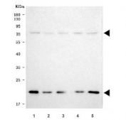 Western blot testing of human 1) HeLa, 2) 293T, 3) U-251, 4) K562 and 5) HepG2 cell lysate with SERAC1 antibody. Predicted molecular weight: 74, 60, 19 kDa (multiple isoforms).