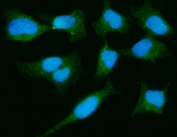 Immunofluorescent staining of FFPE human HeLa cells with Parkinson disease protein 7 antibody (green) and DAPI nuclear stain (blue). HIER: steam section in pH6 citrate buffer for 20 min.