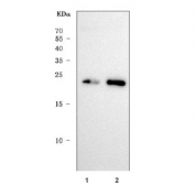 Western blot testing of human 1) U-2 OS and 2) HepG2 cell lysate with Parkinson disease protein 7 antibody. Predicted molecular weight ~20 kDa.